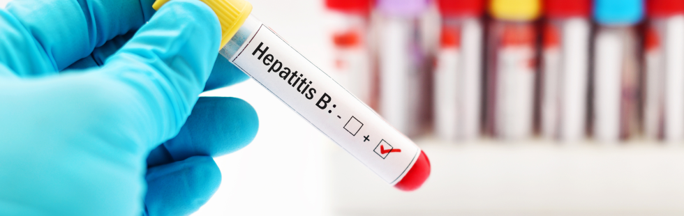 Hepatitis B: prevención y detección oportuna para evitar complicaciones graves en la salud