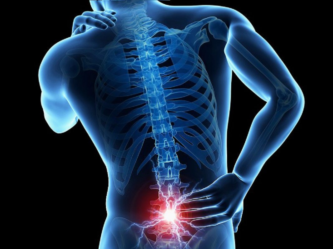 ALREDEDOR DE DIEZ MILLONES DE LATINOAMERICANOS PRESENTA INCAPACIDAD POR DOLOR LUMBAR CRÓNICO