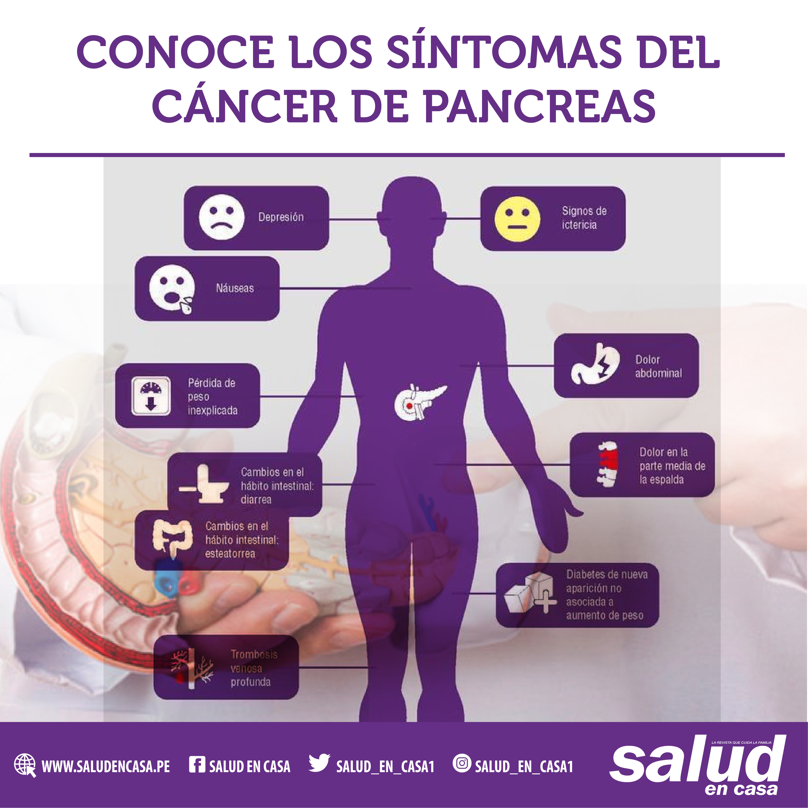 10 cosas que no conocías del cáncer de páncreas