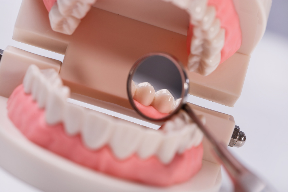 ¿Qué es la limpieza interdental y cómo se aplica correctamente?