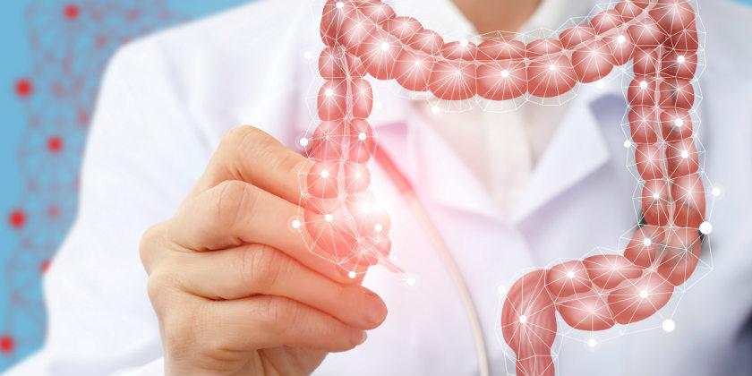 Pacientes con enfermedades inflamatorias intestinales tienen alto riesgo de sufrir cáncer colorrectal