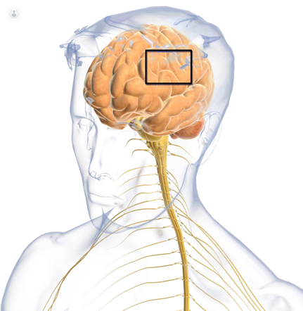 La esclerosis lateral amiotrófica (ELA) , enfermedad degenerativa que requiere mucho cuidado.