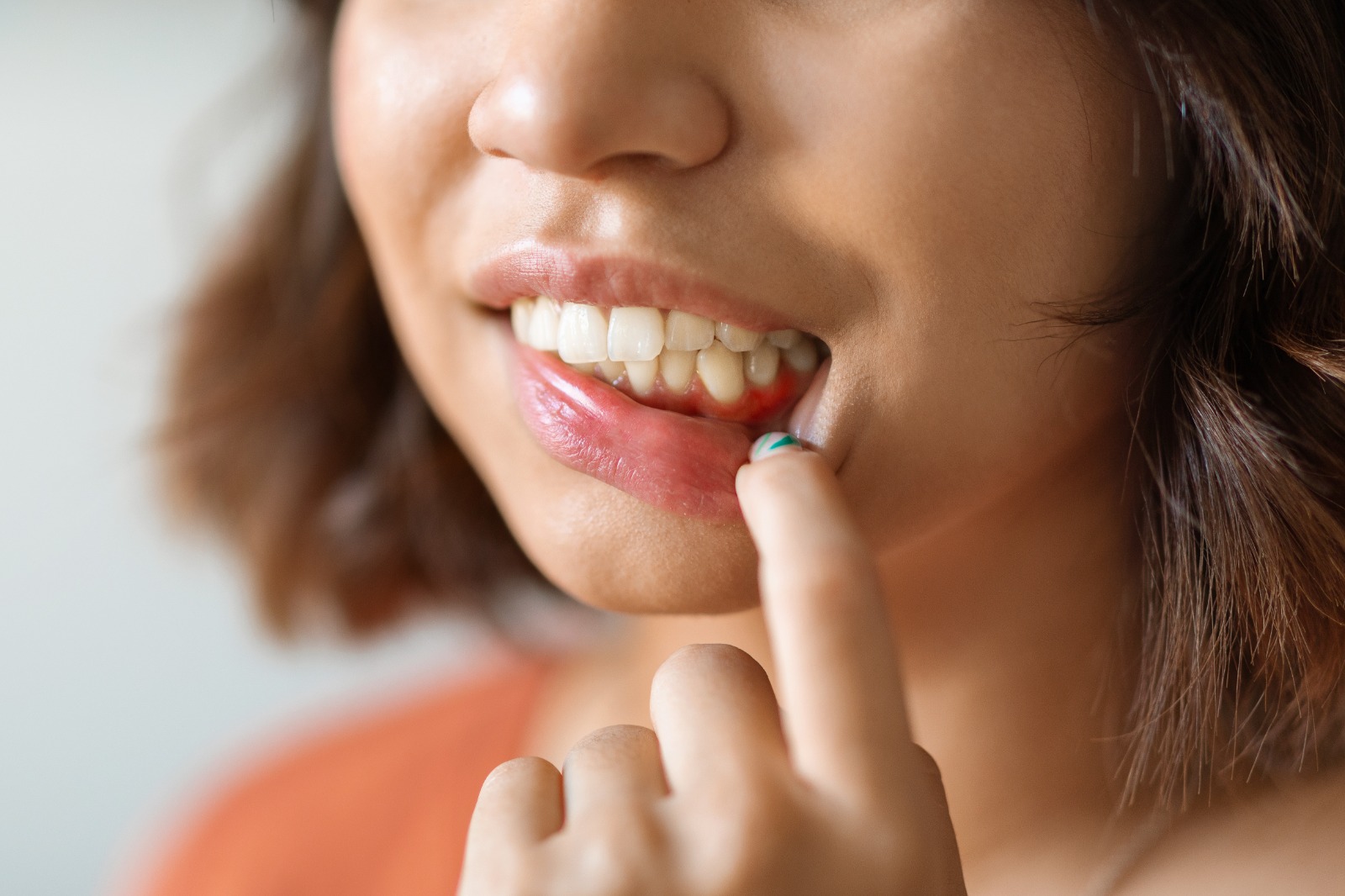 La importancia del cuidado interdental en la prevención de enfermedades de las encías