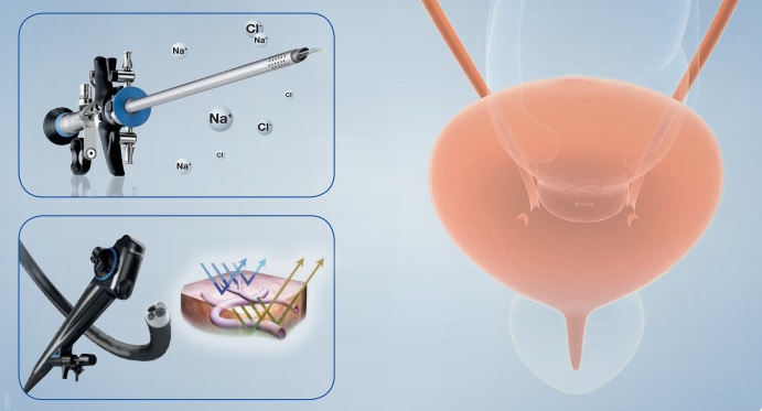 Centro Clínico Urozen adquiere Cistoscopio de avanzada tecnología