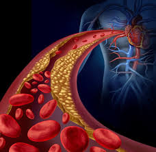 Perú: 1 de cada 4 peruanos sufre de hipertensión o alguna enfermedad cardiovascular